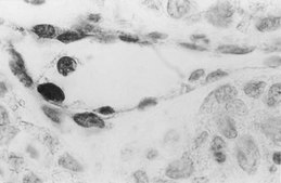 Anti-DNA Antibody, single stranded specific, clone F7-26 clone F7-26, Chemicon®, from mouse