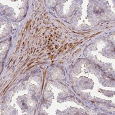 Anti-ARHGAP35 antibody produced in rabbit Prestige Antibodies® Powered by Atlas Antibodies, affinity isolated antibody, buffered aqueous glycerol solution