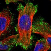 Anti-ERC1 antibody produced in rabbit Prestige Antibodies® Powered by Atlas Antibodies, affinity isolated antibody, buffered aqueous glycerol solution, Ab1
