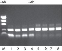 JumpStart™ REDTaq® DNA Polymerase Hot-start Taq enzyme with inert dye, 10X buffer included