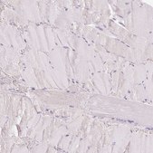Anti-CYP11B2 antibody produced in rabbit Prestige Antibodies® Powered by Atlas Antibodies, affinity isolated antibody, buffered aqueous glycerol solution