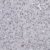 Anti-PPHLN1 antibody produced in rabbit Prestige Antibodies® Powered by Atlas Antibodies, affinity isolated antibody, buffered aqueous glycerol solution