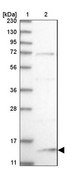 Anti-SNU13 antibody produced in rabbit Prestige Antibodies® Powered by Atlas Antibodies, affinity isolated antibody, buffered aqueous glycerol solution