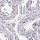 Anti-ZBTB32 Prestige Antibodies® Powered by Atlas Antibodies, affinity isolated antibody