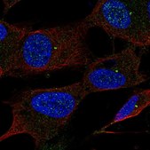 Anti-UBE2Q1 antibody produced in rabbit Prestige Antibodies® Powered by Atlas Antibodies, affinity isolated antibody, buffered aqueous glycerol solution