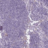 Anti-ATP6V1D antibody produced in rabbit Prestige Antibodies® Powered by Atlas Antibodies, affinity isolated antibody, buffered aqueous glycerol solution