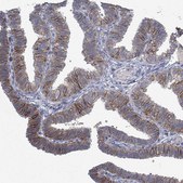 Anti-KRAS antibody produced in rabbit Prestige Antibodies® Powered by Atlas Antibodies, affinity isolated antibody, buffered aqueous glycerol solution