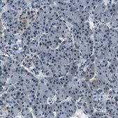 Anti-ING2 antibody produced in rabbit Prestige Antibodies® Powered by Atlas Antibodies, affinity isolated antibody, buffered aqueous glycerol solution