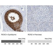 Anti-RCN2 antibody produced in rabbit Prestige Antibodies® Powered by Atlas Antibodies, affinity isolated antibody, buffered aqueous glycerol solution
