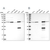 Anti-ALDH6A1 antibody produced in rabbit Prestige Antibodies® Powered by Atlas Antibodies, affinity isolated antibody, buffered aqueous glycerol solution, ab2