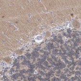 Anti-NCDN antibody produced in rabbit Prestige Antibodies® Powered by Atlas Antibodies, affinity isolated antibody, buffered aqueous glycerol solution