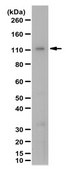 Anti-TRPM8 Antibody from rabbit, purified by affinity chromatography