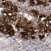 Anti-VAT1L antibody produced in rabbit Prestige Antibodies® Powered by Atlas Antibodies, affinity isolated antibody, buffered aqueous glycerol solution