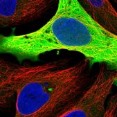 Anti-GAPDH antibody produced in rabbit Prestige Antibodies® Powered by Atlas Antibodies, affinity isolated antibody