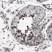 Anti-LNPK antibody produced in rabbit Prestige Antibodies® Powered by Atlas Antibodies, affinity isolated antibody, buffered aqueous glycerol solution