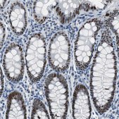 Anti-ECD antibody produced in rabbit Prestige Antibodies® Powered by Atlas Antibodies, affinity isolated antibody, buffered aqueous glycerol solution