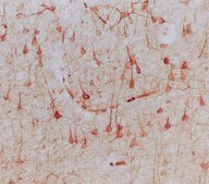 Anti-Internexin α Antibody, CT, clone 2E3 culture supernatant, clone 2E3, Chemicon®