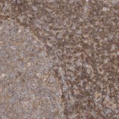 Anti-ANXA11 antibody produced in rabbit Prestige Antibodies® Powered by Atlas Antibodies, affinity isolated antibody, buffered aqueous glycerol solution