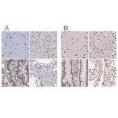 Anti-SREK1 antibody produced in rabbit Prestige Antibodies® Powered by Atlas Antibodies, affinity isolated antibody, buffered aqueous glycerol solution