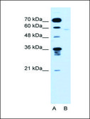Anti-FMO3 antibody produced in rabbit affinity isolated antibody