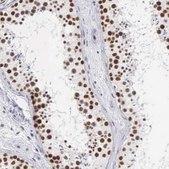 Anti-CSTF2 antibody produced in rabbit Prestige Antibodies® Powered by Atlas Antibodies, affinity isolated antibody, buffered aqueous glycerol solution