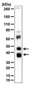 Anti-Tenomodulin/TNMD Antibody 0.5 mg/mL, from rabbit