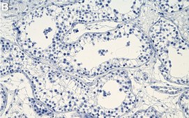 Anti-IKKε Antibody, clone 1D7 ZooMAb® Rabbit Monoclonal recombinant, expressed in HEK 293 cells