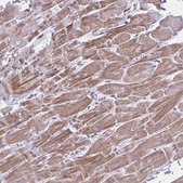 Anti-PITPNM1 antibody produced in rabbit Prestige Antibodies® Powered by Atlas Antibodies, affinity isolated antibody, buffered aqueous glycerol solution