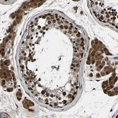Anti-TRIM35 antibody produced in rabbit affinity isolated antibody, buffered aqueous glycerol solution
