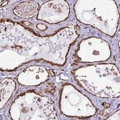 Anti-CHMP1B antibody produced in rabbit Prestige Antibodies® Powered by Atlas Antibodies, affinity isolated antibody, buffered aqueous glycerol solution