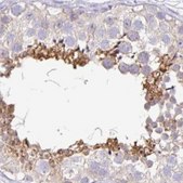 Anti-PLCD4 antibody produced in rabbit Prestige Antibodies® Powered by Atlas Antibodies, affinity isolated antibody, buffered aqueous glycerol solution