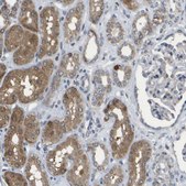 Anti-HADHA antibody produced in rabbit Prestige Antibodies® Powered by Atlas Antibodies, affinity isolated antibody, buffered aqueous glycerol solution