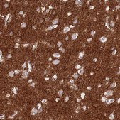 Anti-ATP1A3 antibody produced in rabbit Prestige Antibodies® Powered by Atlas Antibodies, affinity isolated antibody, buffered aqueous glycerol solution