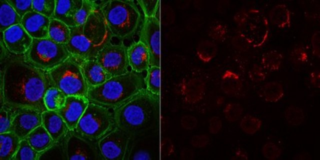 Anti-Cytokeratin 5,6 Antibody, clone D5/16B4, Alexa Fluor&#8482; 555 clone D5/16B4, from mouse, ALEXA FLUOR&#8482; 555