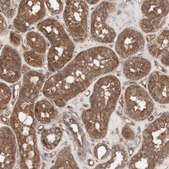 Anti-TFPI antibody produced in rabbit Prestige Antibodies® Powered by Atlas Antibodies, affinity isolated antibody, buffered aqueous glycerol solution