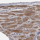 Anti-PPP1R3C antibody produced in rabbit Prestige Antibodies® Powered by Atlas Antibodies, affinity isolated antibody, buffered aqueous glycerol solution