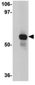 Anti-SRPX2 Antibody from rabbit, purified by affinity chromatography