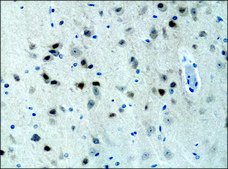 Anti-DSCR1 (C-terminal) antibody produced in rabbit ~1.5 mg/mL, affinity isolated antibody, buffered aqueous solution