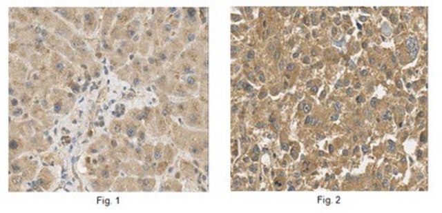 Anti-Serpinf2 Antibody from rabbit, purified by affinity chromatography