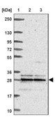 Anti-MRPL16 antibody produced in rabbit Prestige Antibodies® Powered by Atlas Antibodies, affinity isolated antibody, buffered aqueous glycerol solution