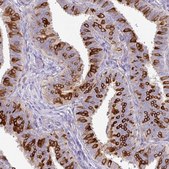 Anti-AGR3 antibody produced in rabbit Prestige Antibodies® Powered by Atlas Antibodies, affinity isolated antibody, buffered aqueous glycerol solution