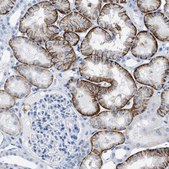 Anti-SLC3A2 antibody produced in rabbit Prestige Antibodies® Powered by Atlas Antibodies, affinity isolated antibody, buffered aqueous glycerol solution