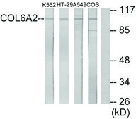 Anti-Collagen VI α2 antibody produced in rabbit affinity isolated antibody