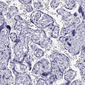 Anti-TSHB antibody produced in rabbit Prestige Antibodies® Powered by Atlas Antibodies, affinity isolated antibody
