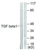 Anti-TGF β1 antibody produced in rabbit affinity isolated antibody
