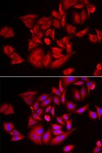 Anti- TLK2 antibody produced in rabbit