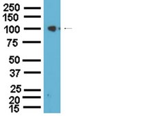 Anti-Na+/K+ ATPase α-1 Antibody Upstate®, from rabbit