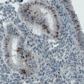 Monoclonal Anti-MKI67 antibody produced in mouse Prestige Antibodies® Powered by Atlas Antibodies, clone CL1234, purified immunoglobulin, buffered aqueous glycerol solution