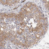 Anti-GIT1 antibody produced in rabbit Ab2, Prestige Antibodies® Powered by Atlas Antibodies, affinity isolated antibody, buffered aqueous glycerol solution