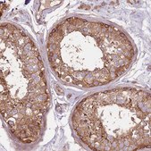 Anti-EMC1 antibody produced in rabbit Prestige Antibodies® Powered by Atlas Antibodies, affinity isolated antibody, buffered aqueous glycerol solution
